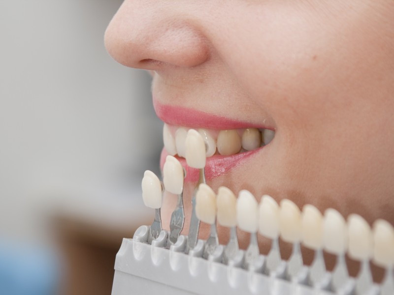 Imagen Rehabilitación oral